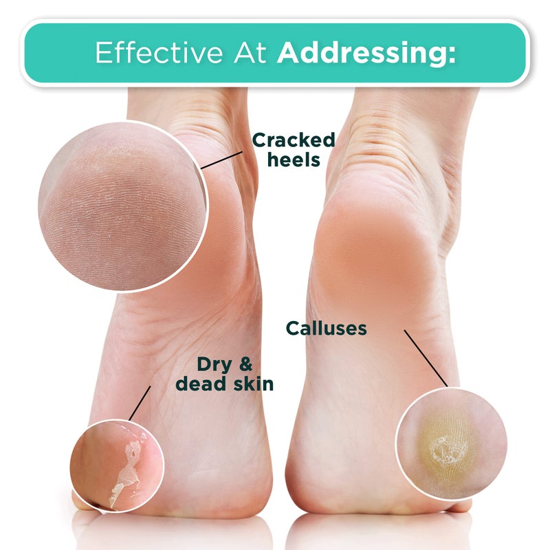 DERMORA Foot Peel Mask | Skin Exfoliating Foot Masks | Dry, Cracked Feet, Callus, Dead Skin Remover | Baby Soft Feet, Tea Tree Scent | Pack of 2 | Regular - Image 4